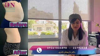میدونستی بدون اینکه جراحی کنی میتونی از شر چربی هات خلاص بشی