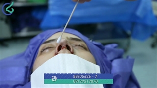 جراحی بینی در اتاق عمل دکتر بصام
