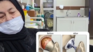 فیلم رضایت بیمار از تعویض مفصل لگن