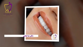 اصلاح طرح لبخند