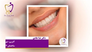 اصلاح طرح لبخند
