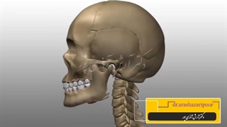 جابجایی دیسک مفصل فک
