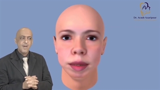 آیا جراحی فک محدودیت سنی دارد؟