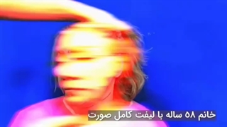 لیفت کامل صورت