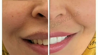 لبخند زیبا در کنار ما