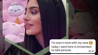 جراحی زیبایی بینی برای بیمار عزیز از netherlands