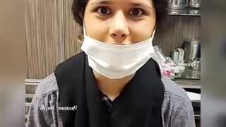 جراحی زیبایی بینی