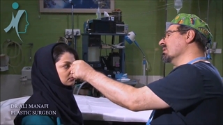 ماساژ بینی