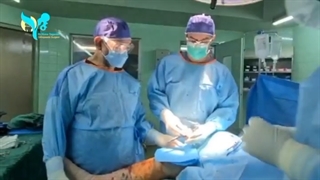 فیلم واقعی تعویض مفصل زانو