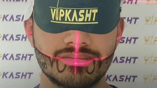 کاشت ریش با لیزر 3 بعدی در کلینیک vip تهران