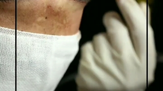 کاشت ریش با لیزر 3 بعدی در کلینیک vip تهران