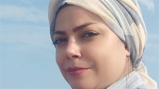 رینوپلاستی خانم