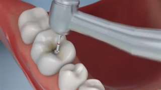 مواد آلژینات دندان پزشکی در سبحان دنتال