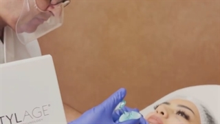 لیفت صورت و کانتورینگ چانه