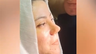 جراحی بینی ترمیمی