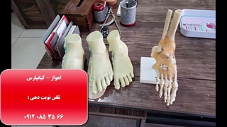 بزرگترین کلینیک ارتوپدی فنی (کلینیک اورتز-پروتز) در اهواز و استان خوزستان