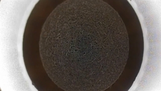 عمل فمتو اسمایل (Femto Smile) که به نام عمل ریلکس اسمایل (ReLex Smile) هم شناخته میشود.