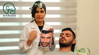 جراحی بینی طبیعی