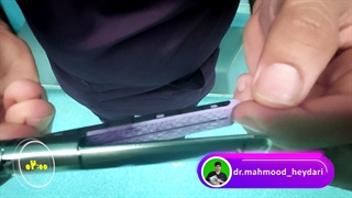 منگه جراحی چیه و چه کاربردهایی داره؟ | دکتر محمود حیدری | جراحی لاپاراسکوپی