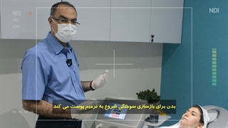 آموزش لایه برداری با تیکسل