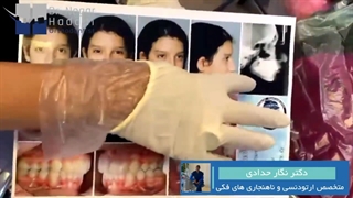 درمان ارتودنسی توسط دکتر نگار حدادی پیلینگ
