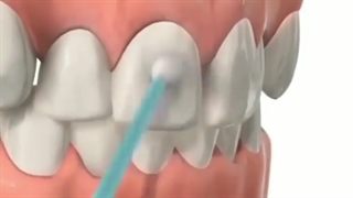 درمان ارتودنسی