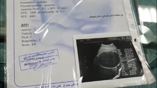 بعد از 13 سال ناباروری ,باردار شد!