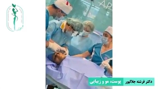 ورکشاپ پیشرفته لیفت با نخ اپتوس در گرجستان