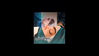 عمل زیبایی بینی یا رینوپلاستی