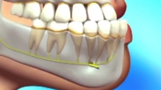 انیمیشن ارتودنسی