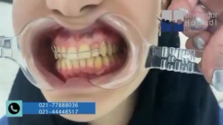 نمونه کار ارتودنسی