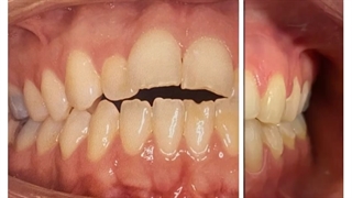 نمونه کار ارتودنسی