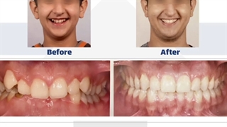 نمونه کار ارتودنسی