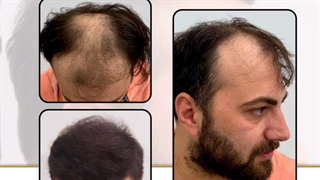 رضایت مراجعه کننده بعد از 2سال