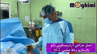 عمل جراحی آرتروسکوپی زانو