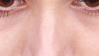 جراحی بینی به این نچرالی دیده بودین؟