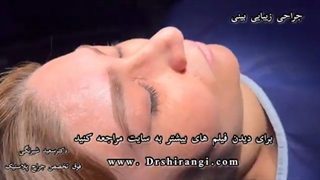 تغییر شکل بینی با جراحی بینی