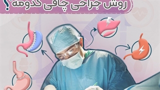 بهترین روش جراحی چاقی کدومه؟