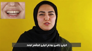 اصلاح طرح لبخند (لبخند هالیوودی) و خنده زیبا - دندانپزشکی عرشیان