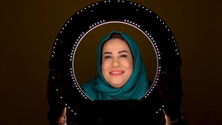 سفید کردن دندان های زرد با کامپوزیت ونیر