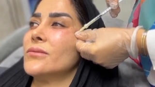 جوانسازی پوست با تزریق Bio Filler Maker