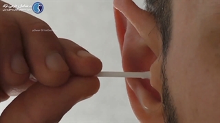 عوارض استفاده از گوش پاک کن