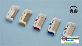 چگونه دندان ها را در سیستم اینویزیلاین استریپ کنیم