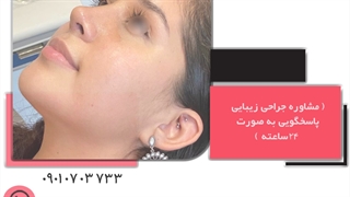 جراح بینی طبیعی