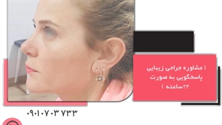 جراحی بینی طبیعی درشهر مشهد