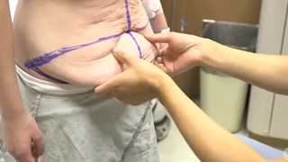 بهترین کلینیک لاغری تهران