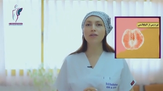 مراقبت بعد از لابیاپلاستی