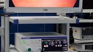 جراحی فتق بزرگ