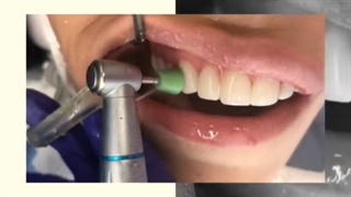 مراحل پالیش کامپوزیت ونیر