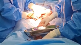 فیلم زایمان سزارین